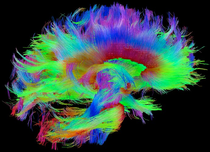 You are currently viewing Could these three brain regions be the seat of consciousness? | KurzweilAI